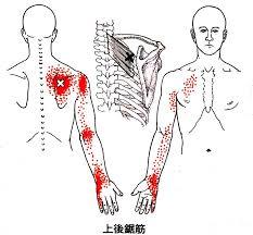 腕が上がらない悩み 四十肩 五十肩 と呼ばれている症状の 初期症状 動画 写真解説 丸太ヨガ 東京都多摩市聖蹟桜ヶ丘 セルフメンテナンス 川村教室