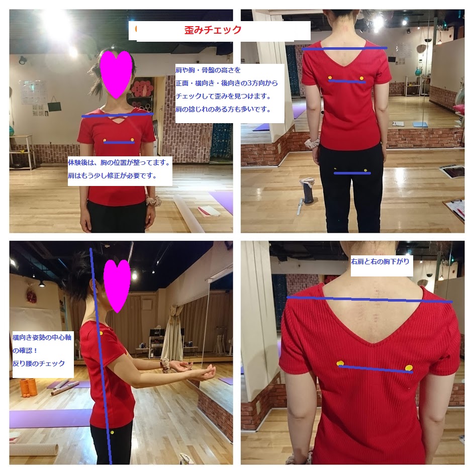 身体が歪んでいるのが気になるけれど何処が歪んでいるか解らない方 3名限定 19年4月14日 東京都 こくちーずプロ